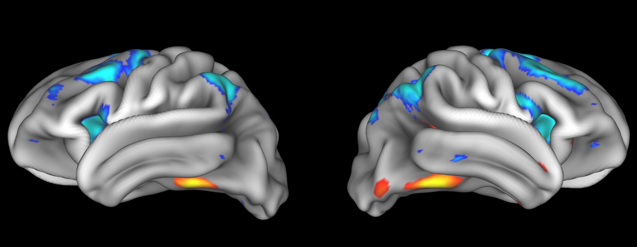 MRI of Adolescent Brain