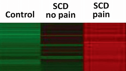 SCD image card