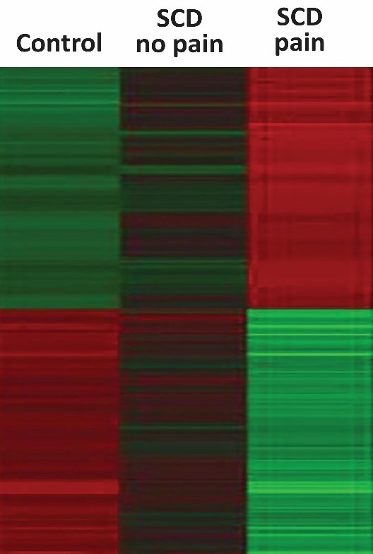 Heat map of inflammatory index