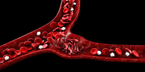 Illustration of sickle-shaped blood cells