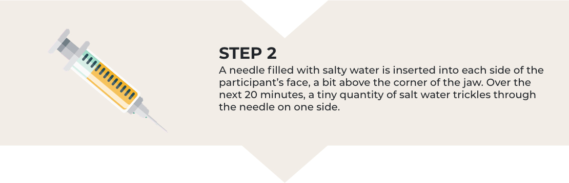 Step 2. A needle filled with salty water is inserted into each side of the participant's face, a bit above the corner of the jaw. Over the next 20 minutes, a tiny quantity of salt water trickles through the needle on one side.