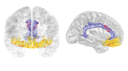 A cross section of the brain highlighting different areas of the brain.