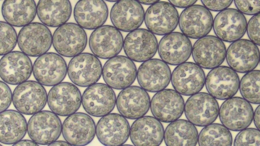 Microgel spheres containing stem cells for injection into intervertebral discs. 