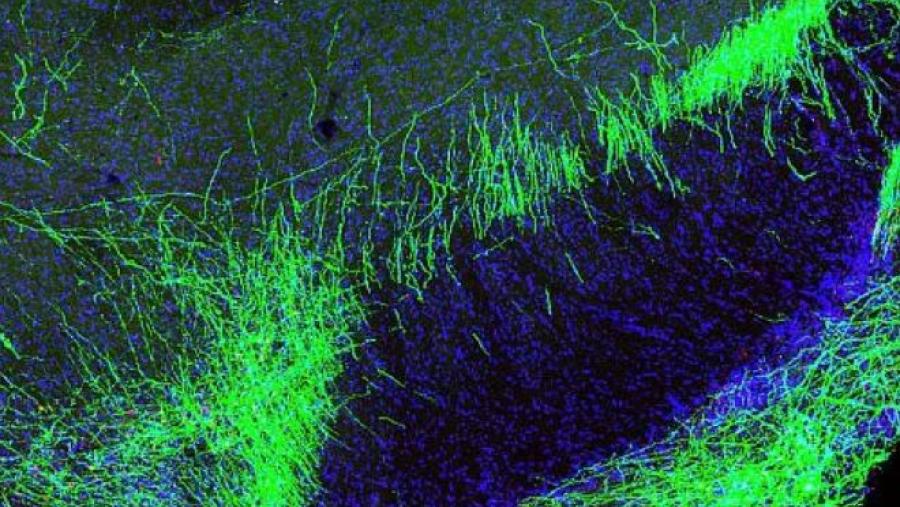 Green and blue Illustration of neurons.