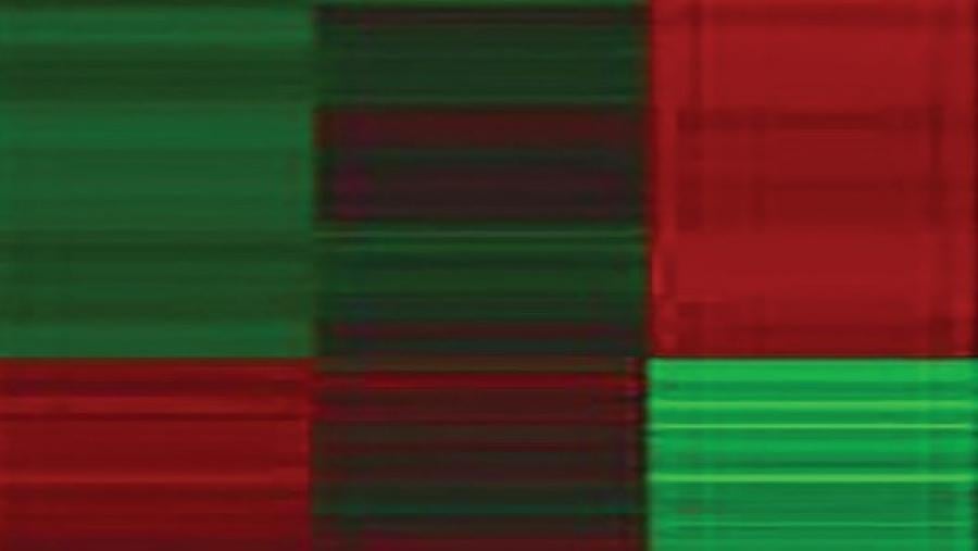 Heat map of inflammatory index