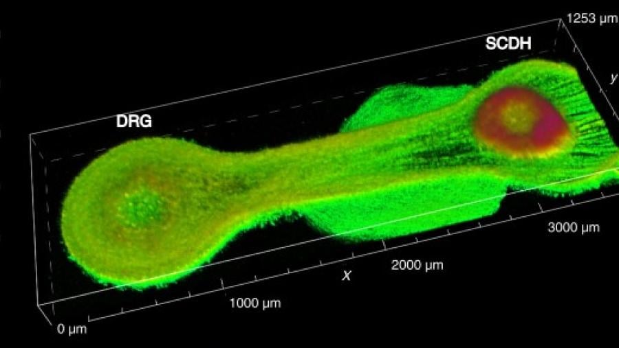 3D image of a “living circuit” in which DRG cells form long extensions toward SCDH cells.