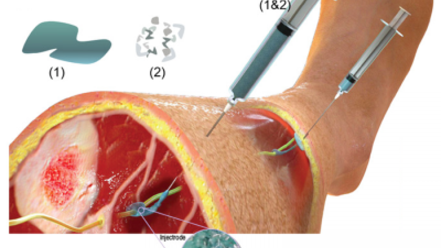 Image of a nerve stimulator, a kind of electrode, being applied. 