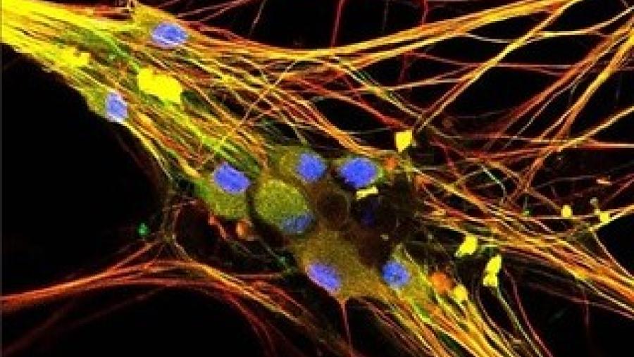 An image of sensory neurons