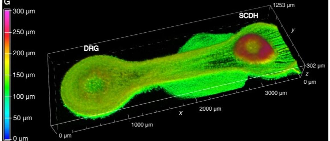 3D image of a “living circuit” in which DRG cells form long extensions toward SCDH cells.